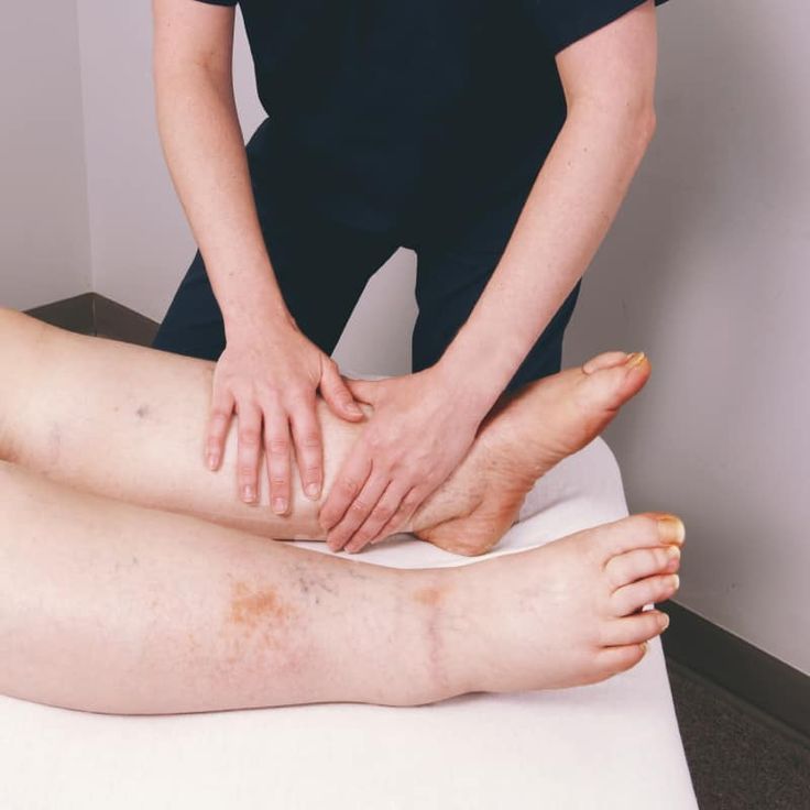 Lymphoedema