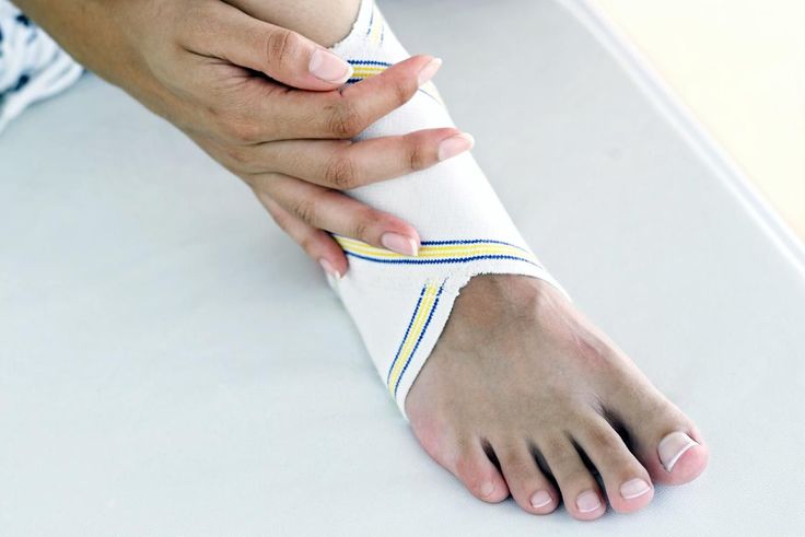 Stress Fractures