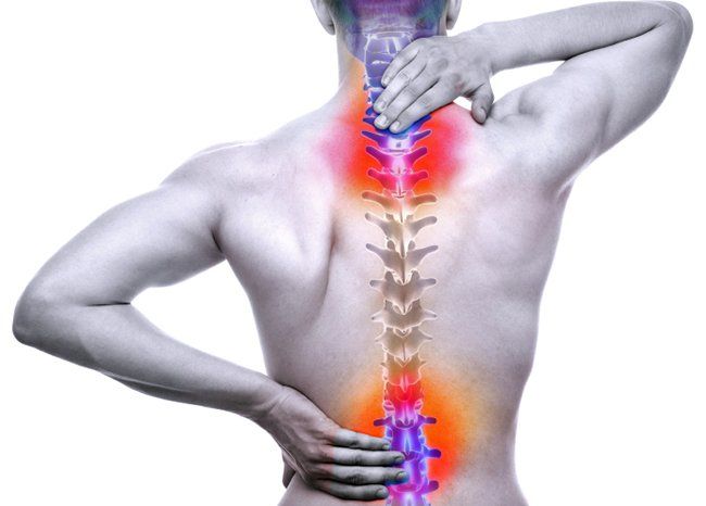 Spinal Cord Injury